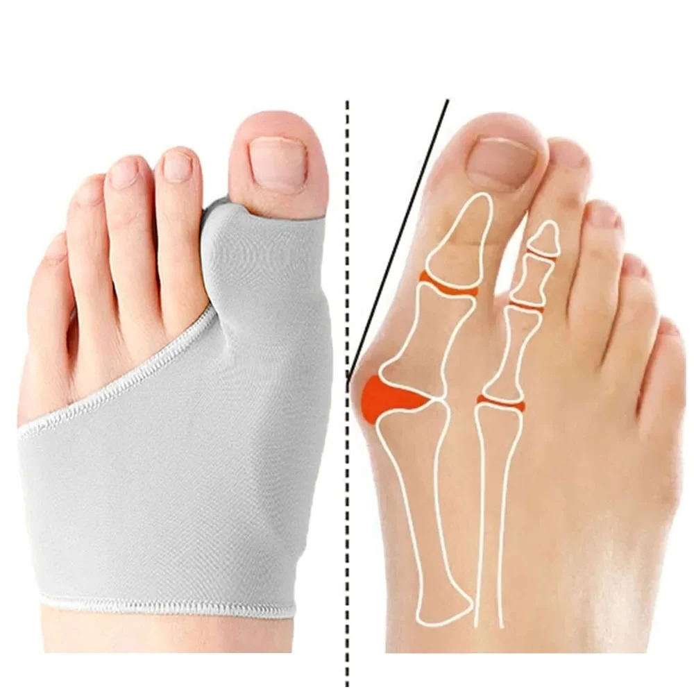 1/2 คู่ Toe Separator Hallux V - Ankle Brace Sock บทวิจารณ์และราคา